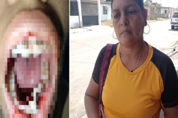 Madre de estudiante agredida: pide destitución de directivos del liceo Luis Beltrán Prieto Figueroa